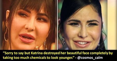 Amp 39 Why Kat Did It Amp 39 Internet Feels Katrina Spoiled Her Beautiful Face With Plastic Surgeries