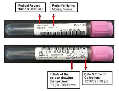 Blood Bank Specimens Specimen Labeling