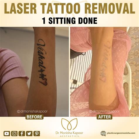 How To Apply Remove Temporary Tattoos 5 Removal Ways Tested Artofit