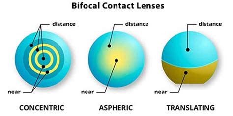 What Are Bifocal Contact Lenses Metro Brazil Blog